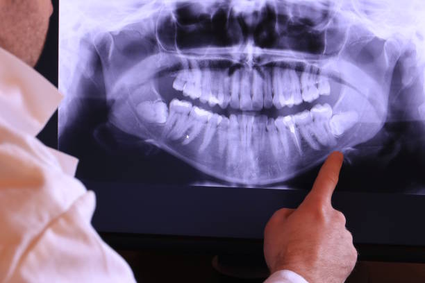 Best Chipped Tooth Repair Near Me  in Carthage, TX